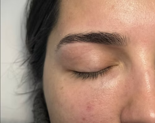 Depilação com Linha
